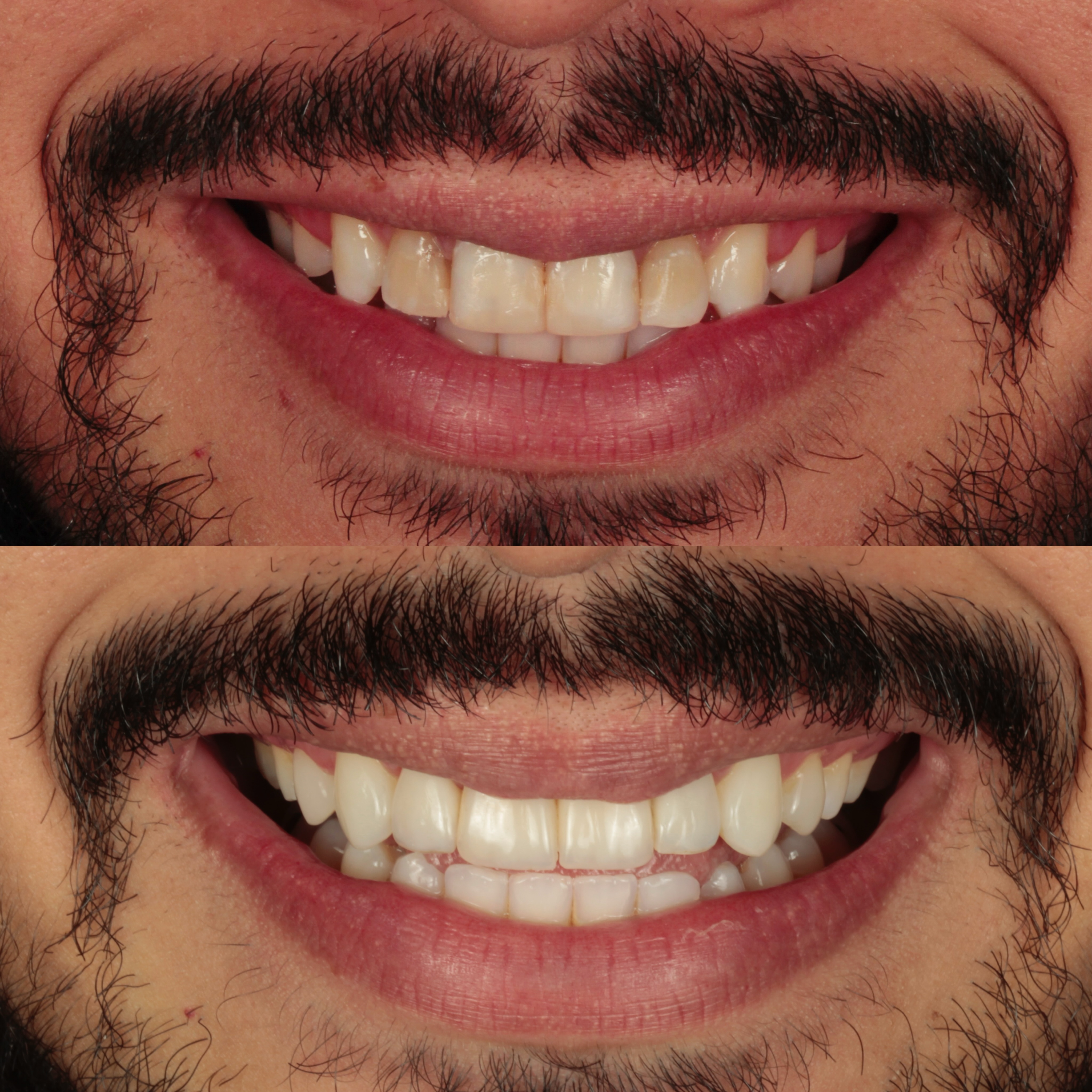 Profissional HOPE realizando atendimento odontológico de alta precisão